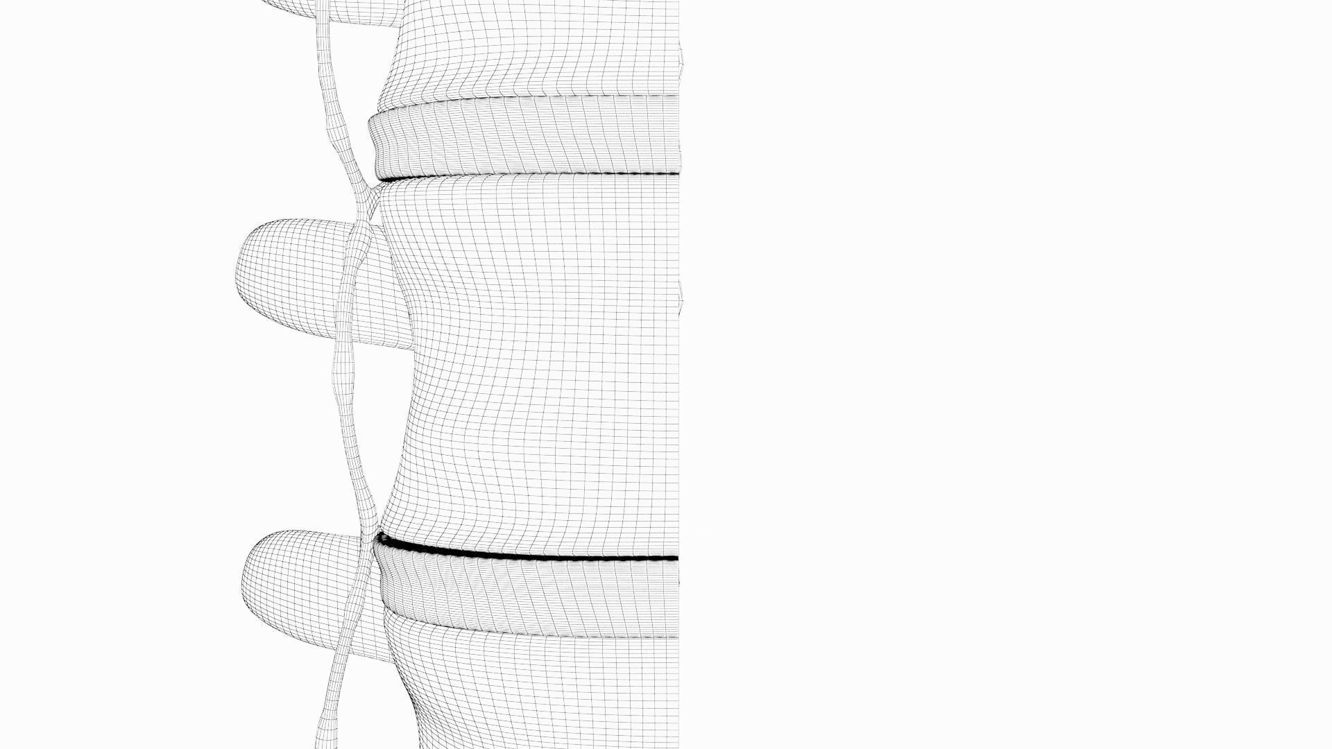 Slipped Bulging Herniated Herniation Disc Spine 3D model_41