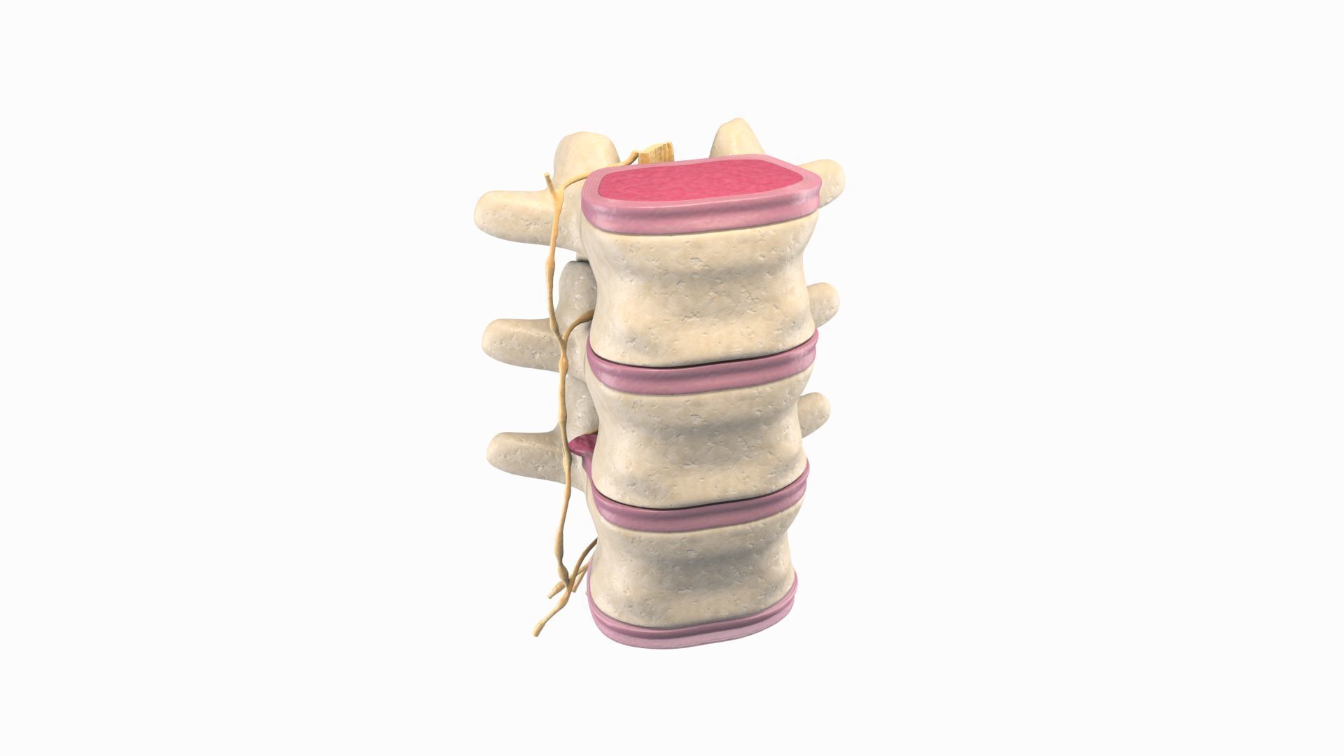 Slipped Bulging Herniated Herniation Disc Spine 3D model_16