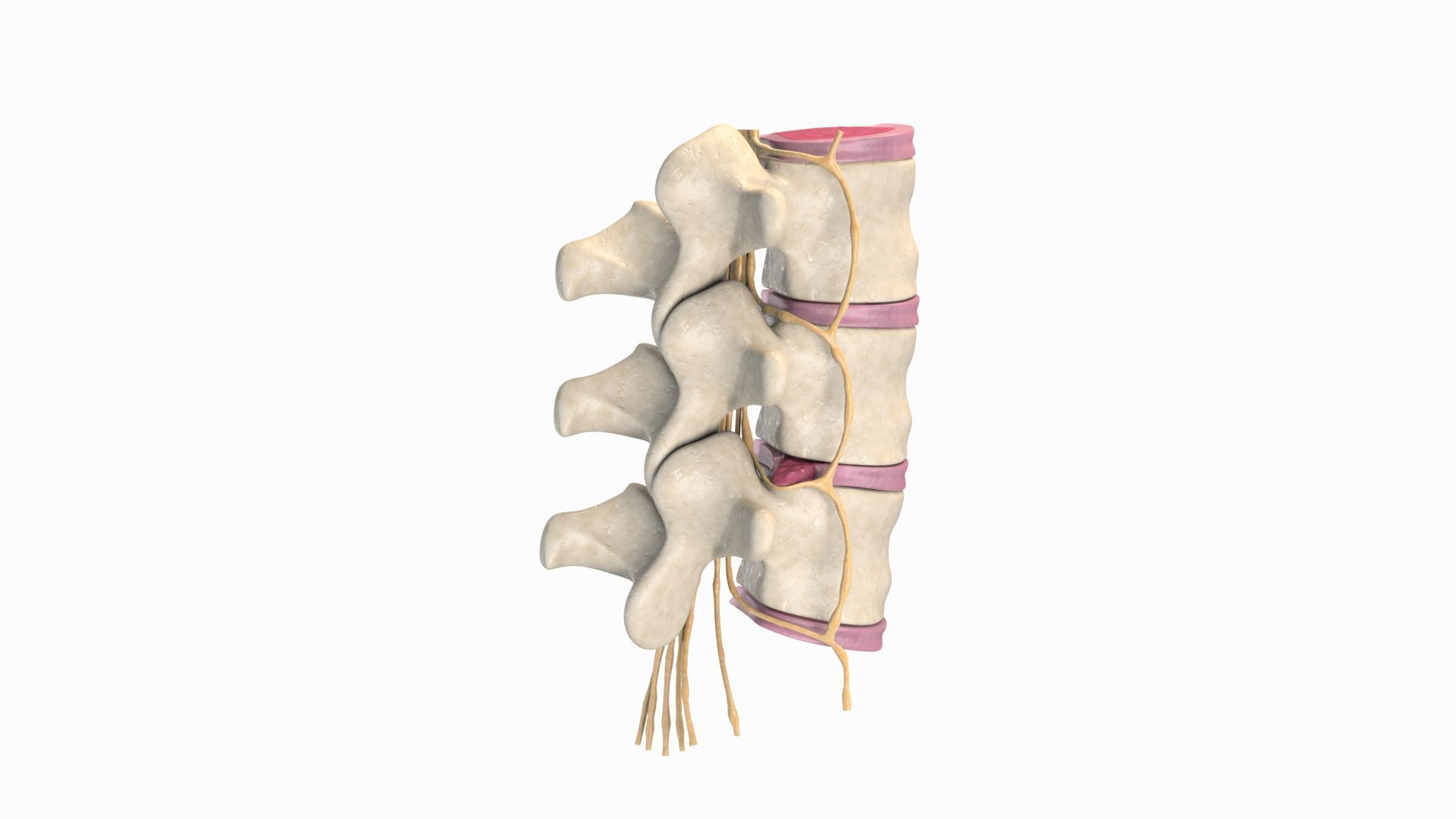 Slipped Bulging Herniated Herniation Disc Spine 3D model_4