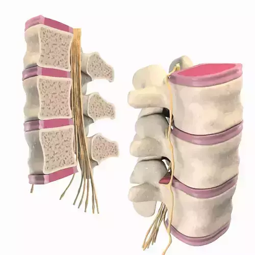 Slipped Bulging Herniated Herniation Disc Spine