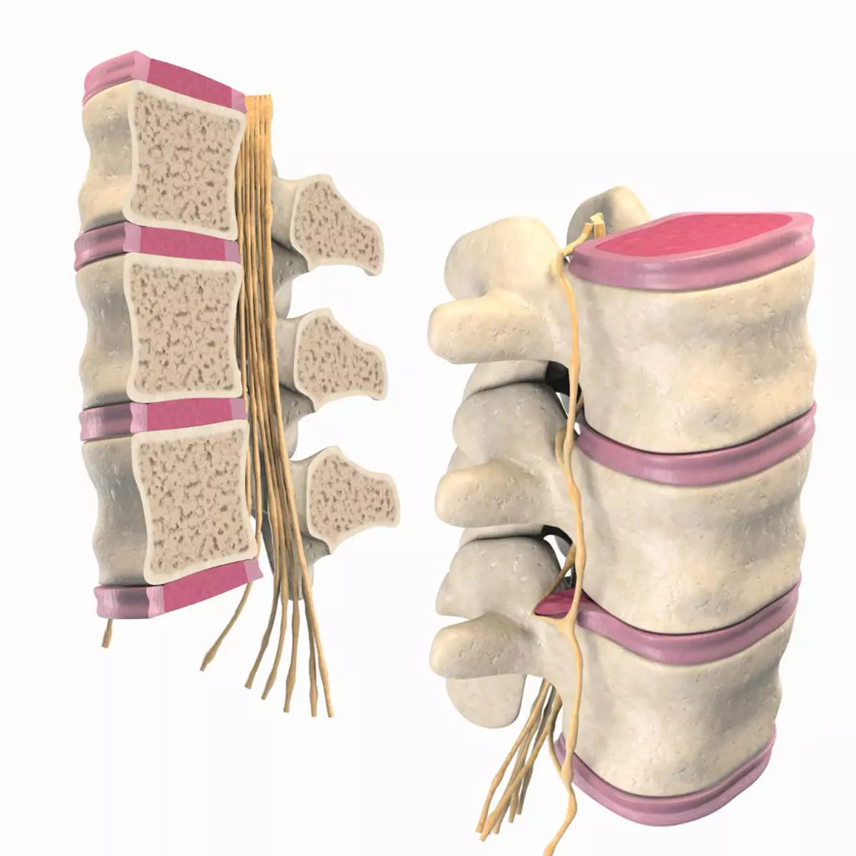 Slipped Bulging Herniated Herniation Disc Spine 3D model_0