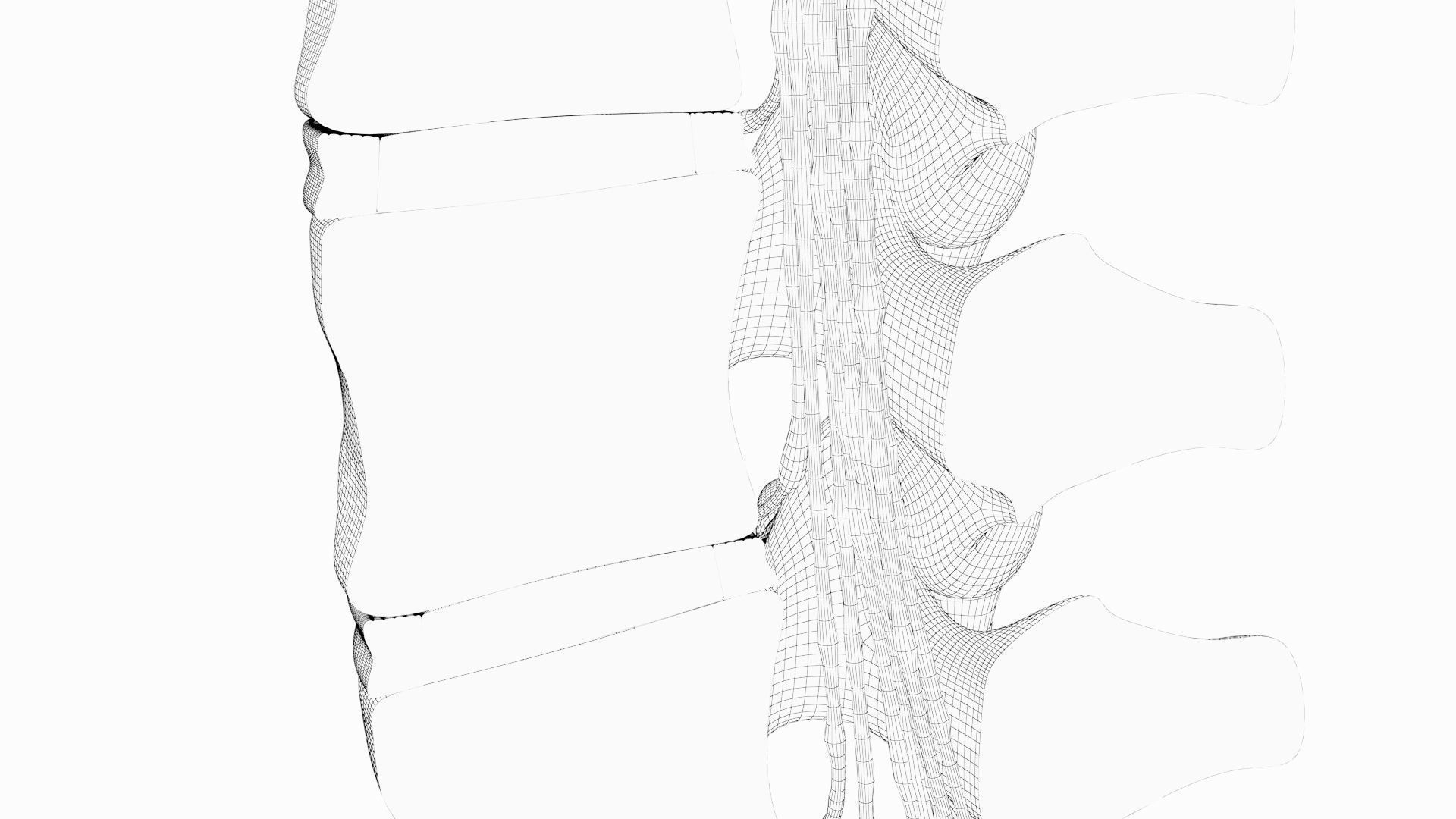 Slipped Bulging Herniated Herniation Disc Spine 3D model_39