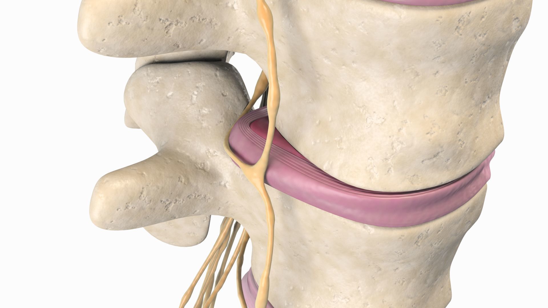 Slipped Bulging Herniated Herniation Disc Spine 3D model_22