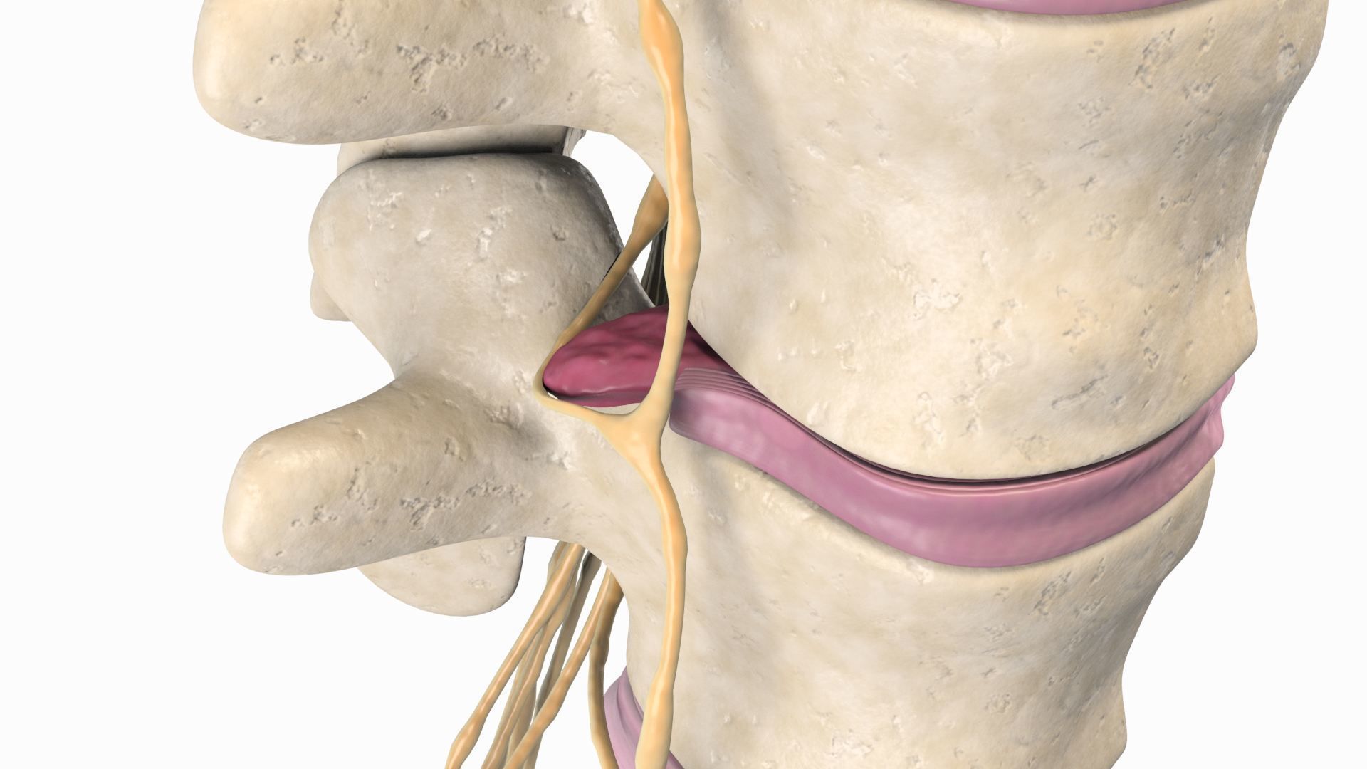 Slipped Bulging Herniated Herniation Disc Spine 3D model_25