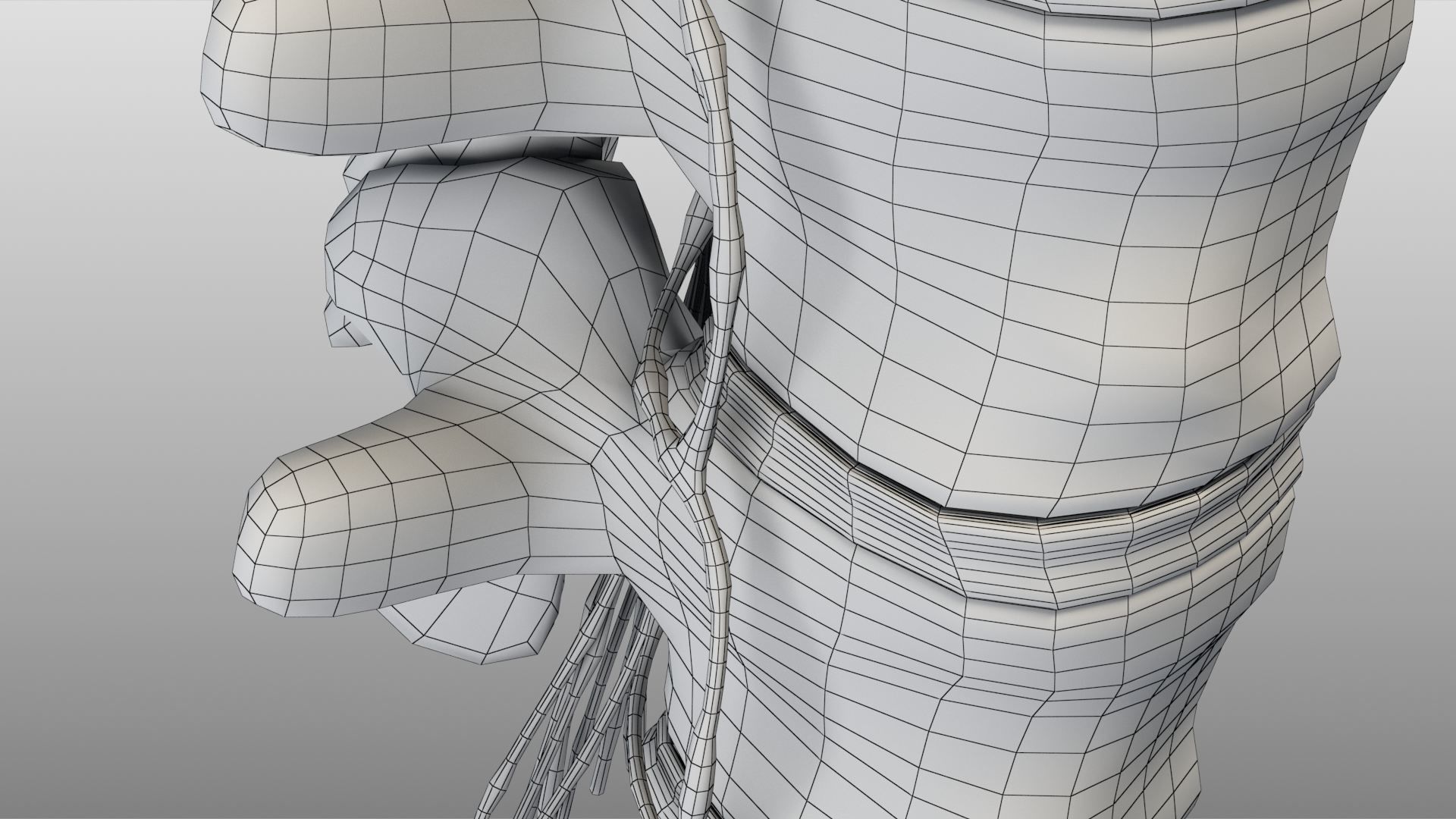 Slipped Bulging Herniated Herniation Disc Spine 3D model_50