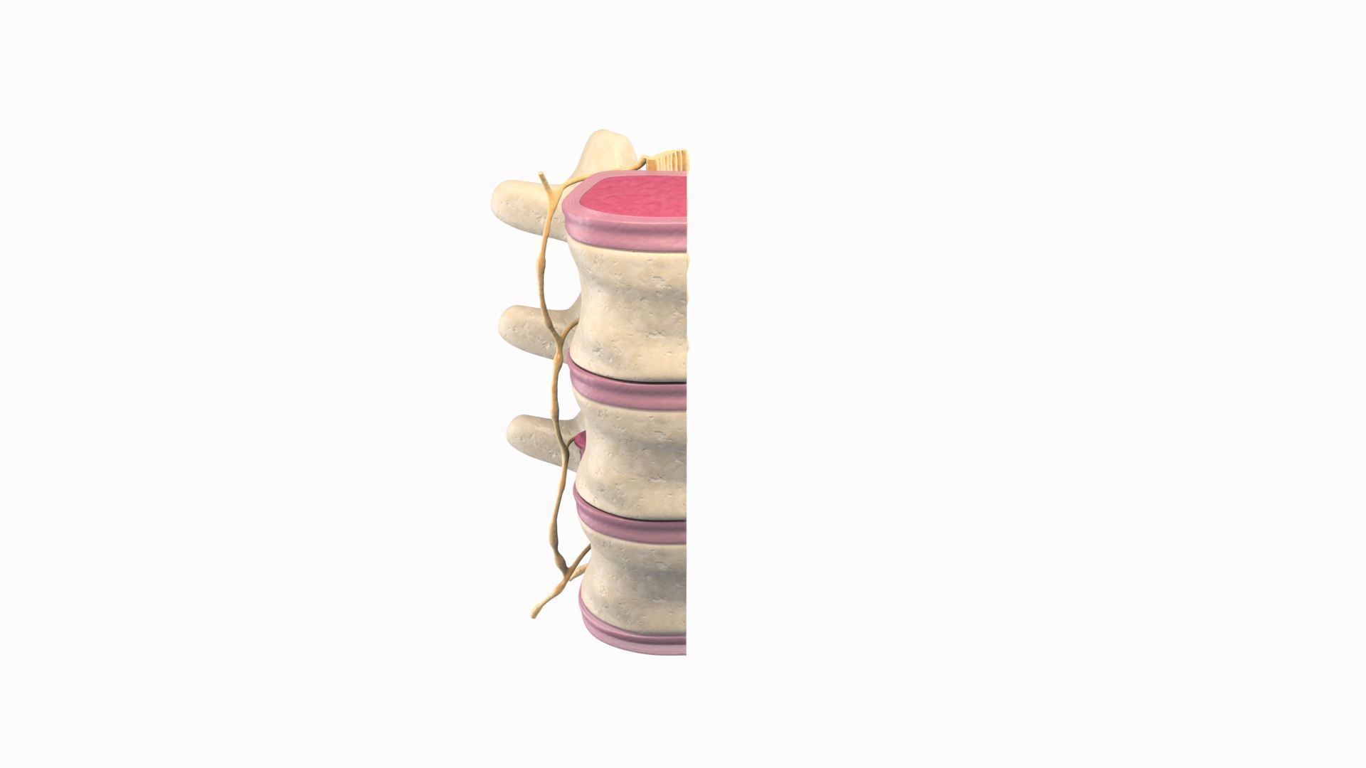Slipped Bulging Herniated Herniation Disc Spine 3D model_1