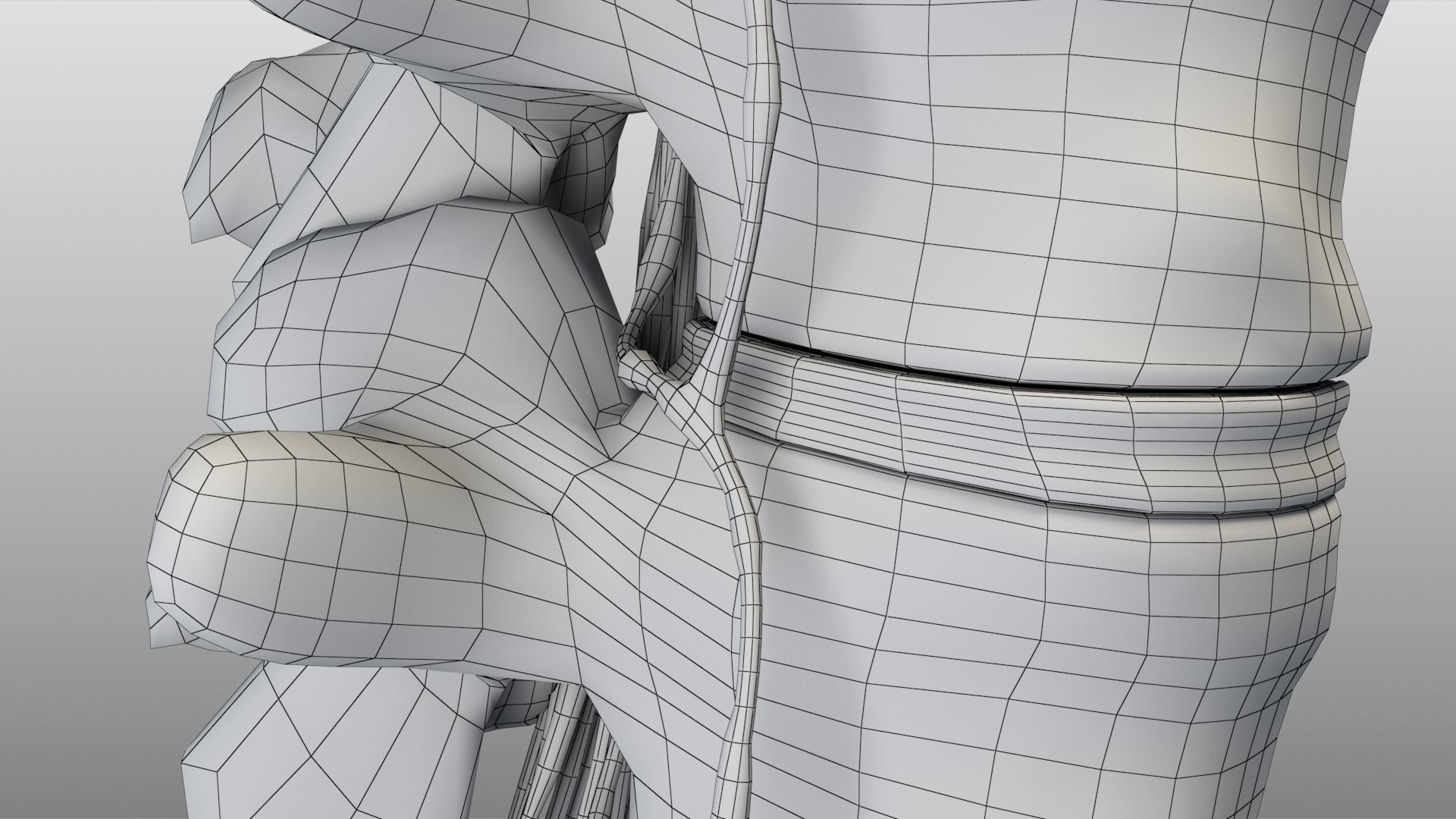 Slipped Bulging Herniated Herniation Disc Spine 3D model_51