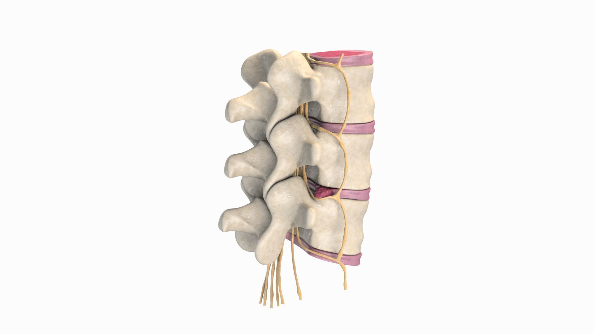 Slipped Bulging Herniated Herniation Disc Spine 3D model_18