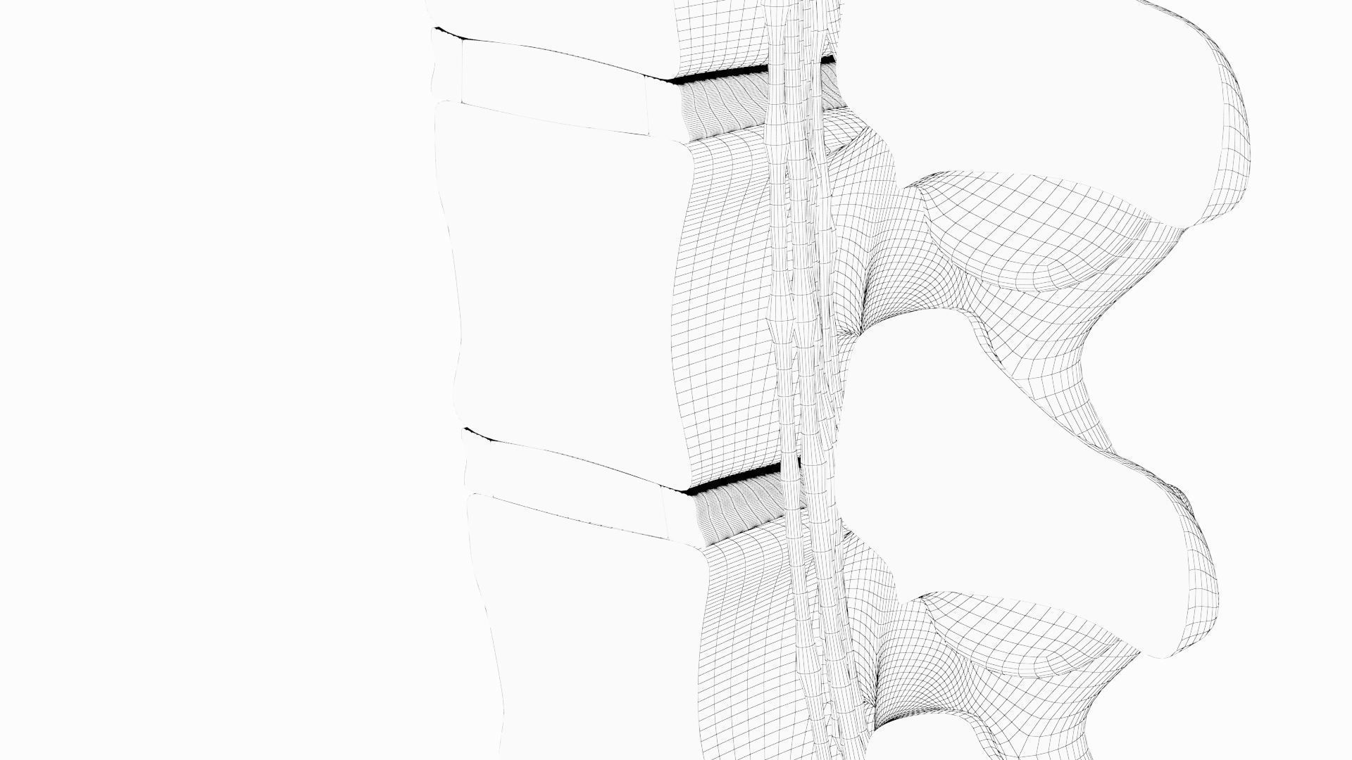 Slipped Bulging Herniated Herniation Disc Spine 3D model_38