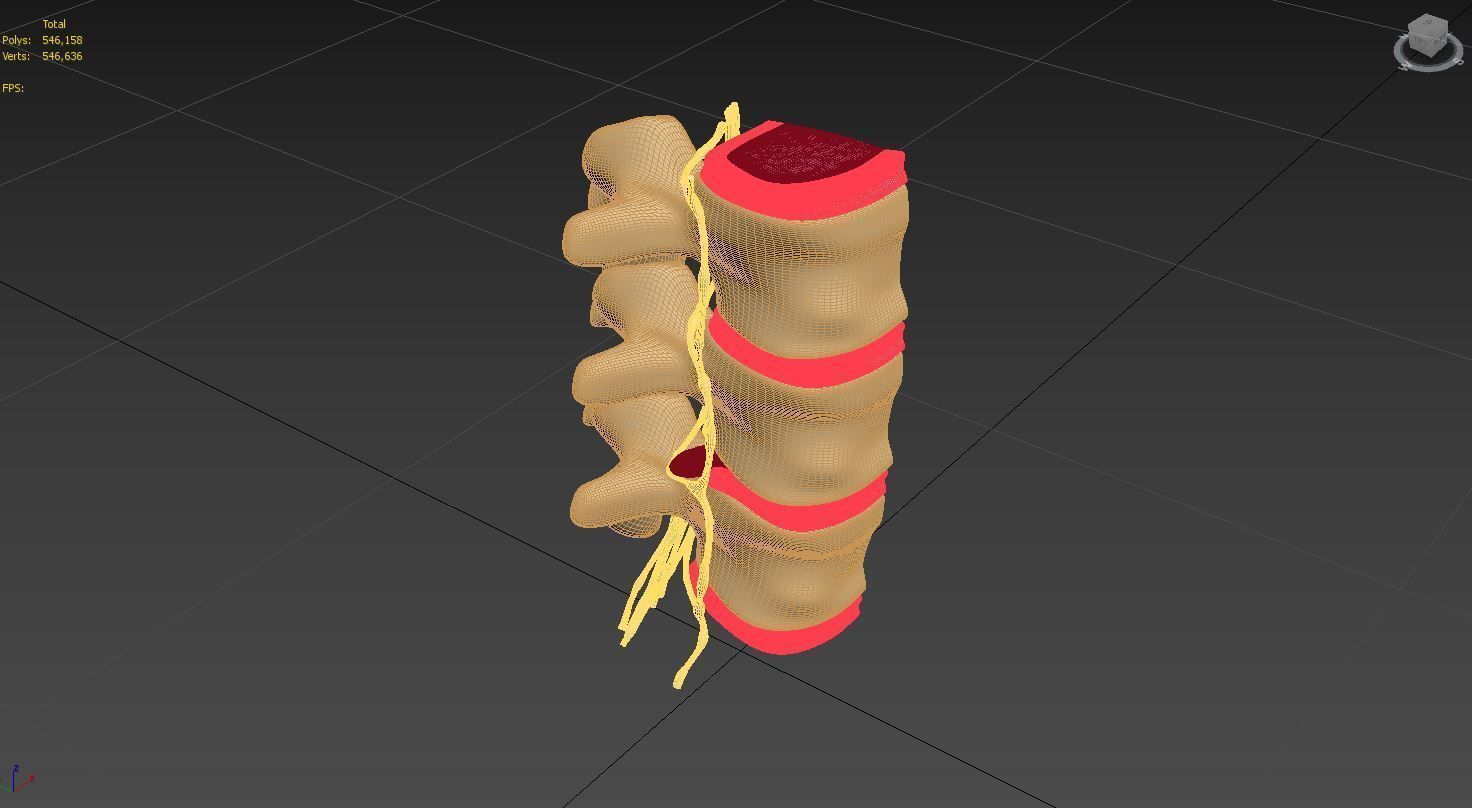 Slipped Bulging Herniated Herniation Disc Spine 3D model_53