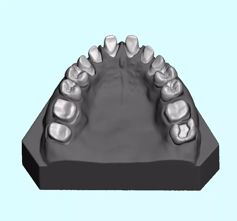 Dental sample model for maxillary 3D print model