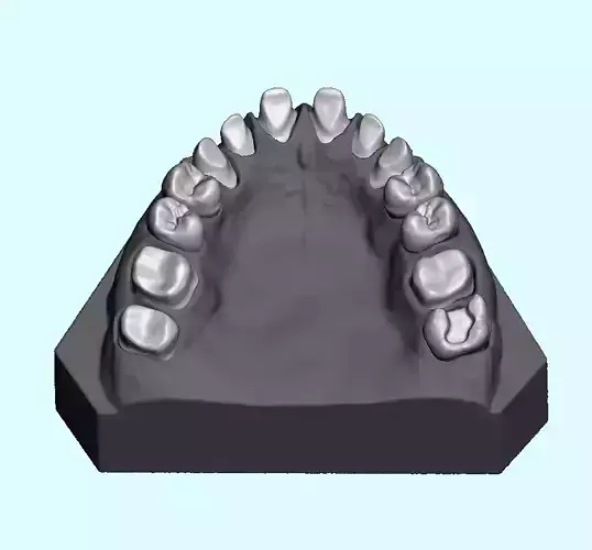 Dental sample model for maxillary 
