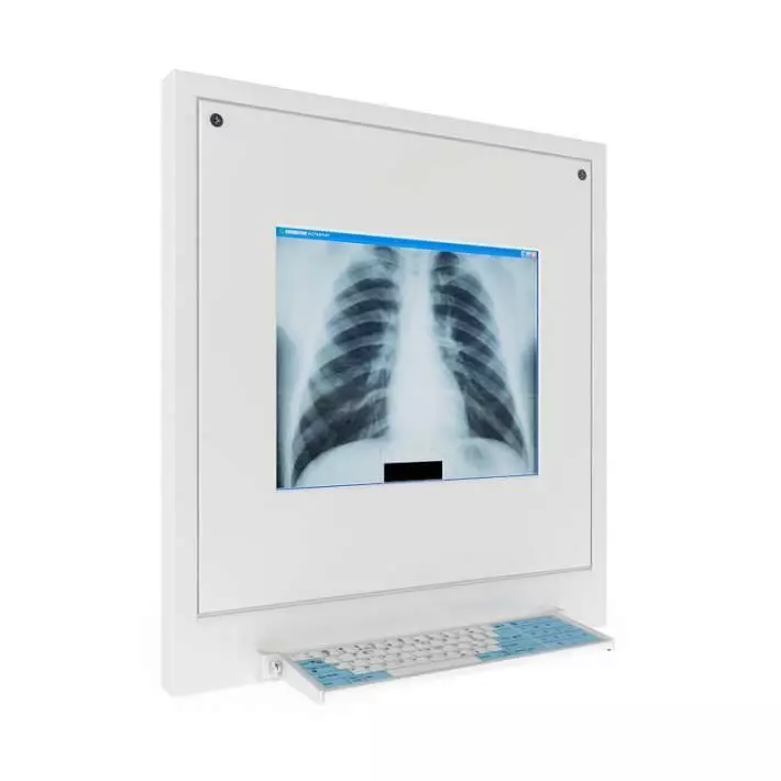 Model X Ray Display 3D model_0