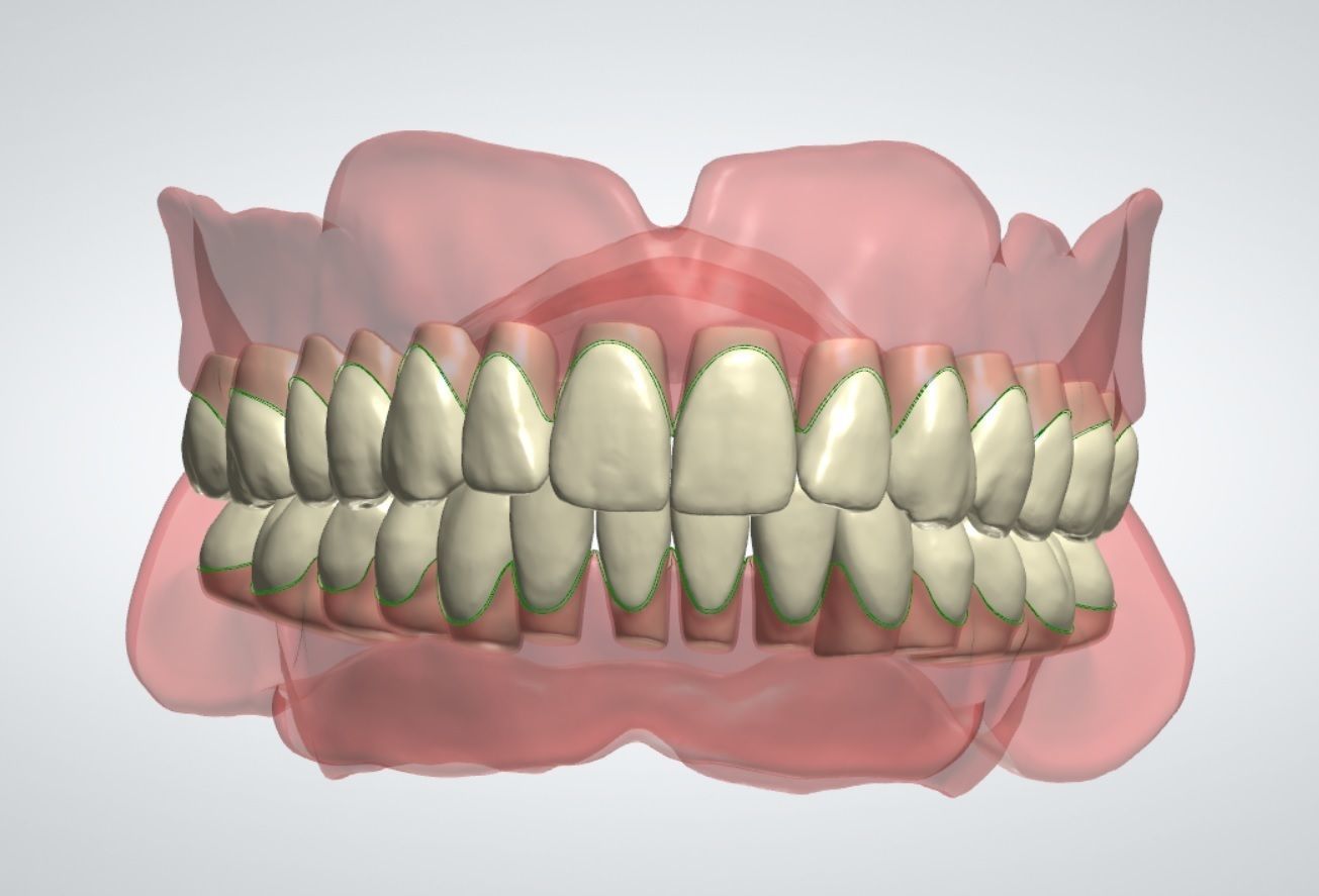 Digital denture Teeth with roots 3D model_1