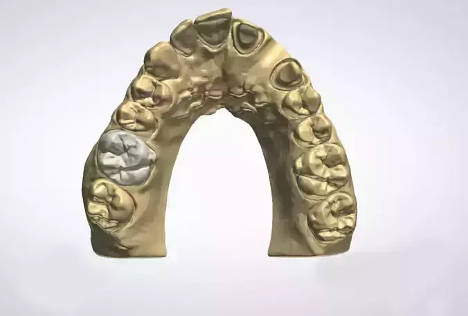 Dental model crown