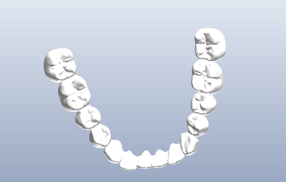 Digital denture  bridged teeth 3D model_4