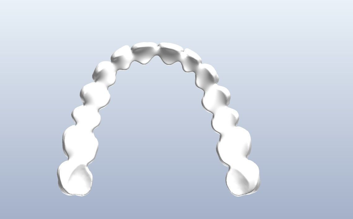 Digital denture  bridged teeth 3D model_2