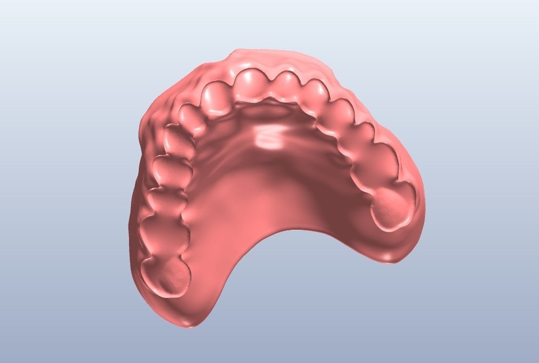 Digital denture  bridged teeth 3D model_1