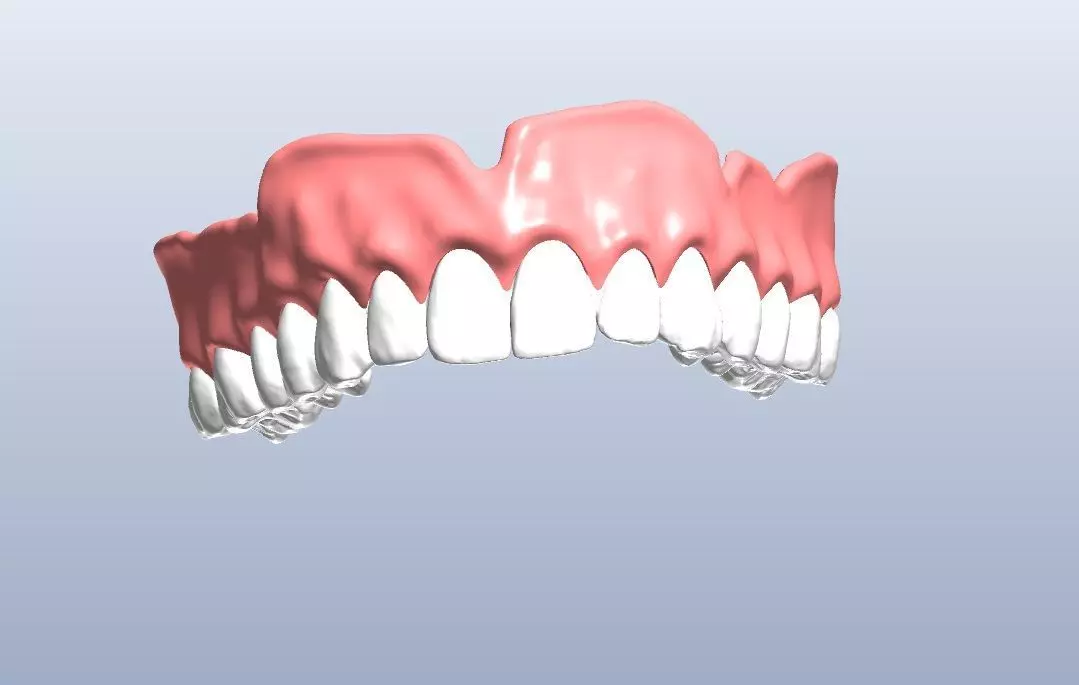 Digital denture  bridged teeth 3D model_0