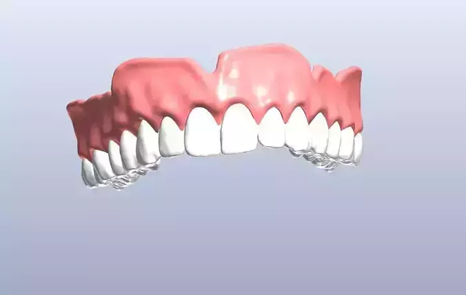 Digital denture  bridged teeth