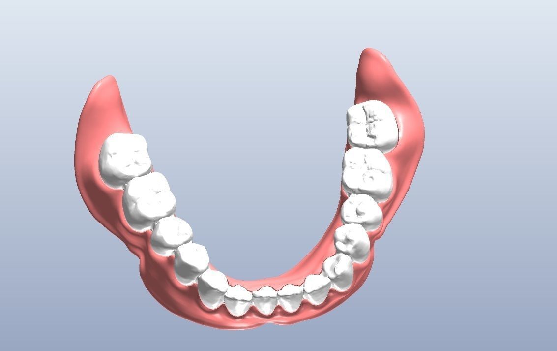 Digital denture  bridged teeth 3D model_3