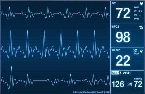 Anesthesia Device 3D model_3