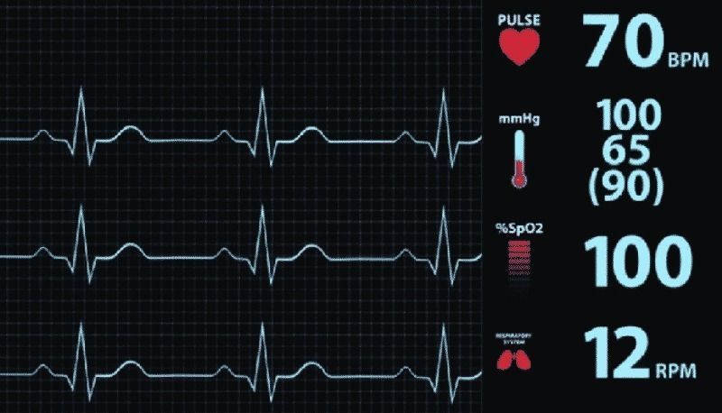Anesthesia Device 3D model_5