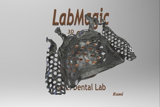 New Digital RPD Frame  3D print model