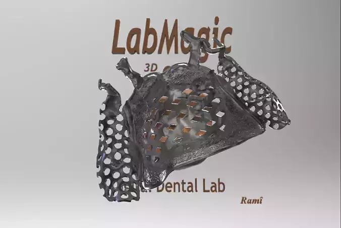 New Digital RPD Frame 