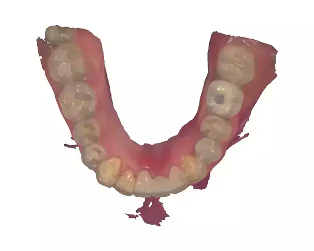 dental inlay model 3D print model