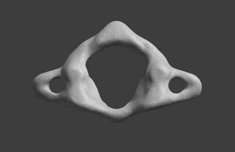 Atlas C1 vertebra 3D print model