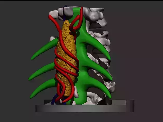 FAMOUS GREYS ANATOMY TUMOR 3D print model