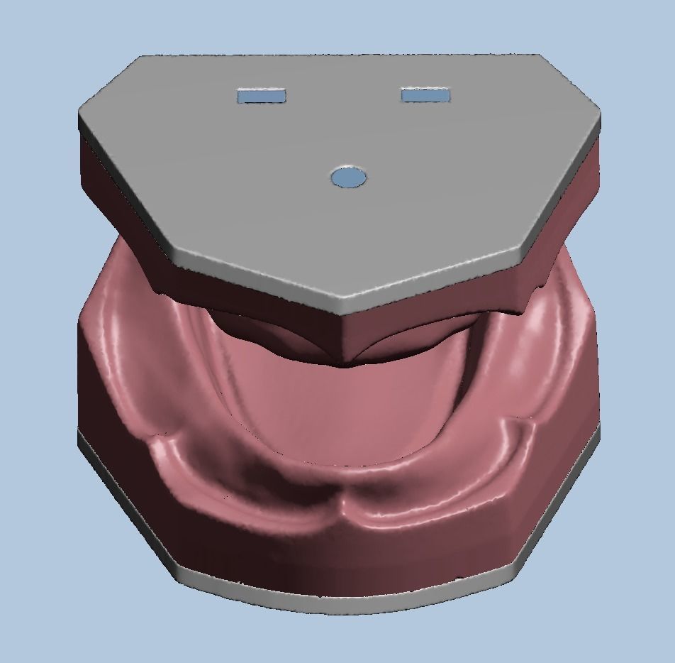 Dental edentulous model separate gum and bone 3D print model_9