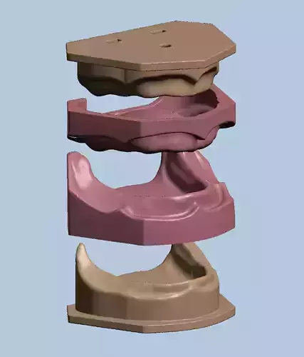 Dental edentulous model separate gum and bone 3D print model