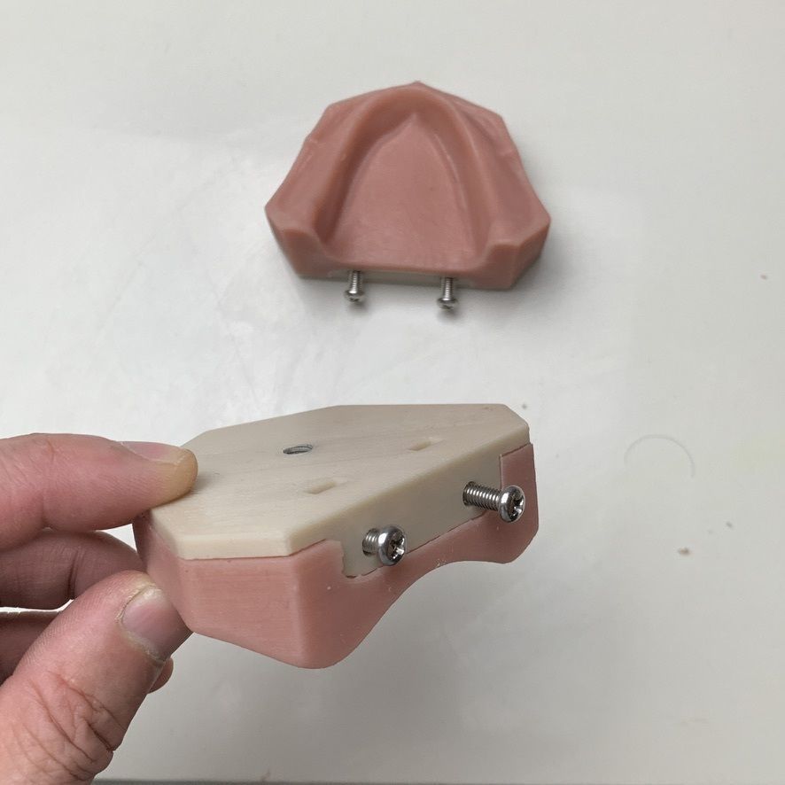 Dental edentulous model separate gum and bone 3D print model_5