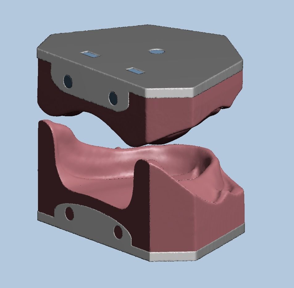 Dental edentulous model separate gum and bone 3D print model_8