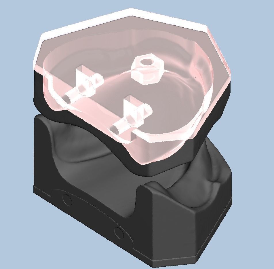 Dental edentulous model separate gum and bone 3D print model_7