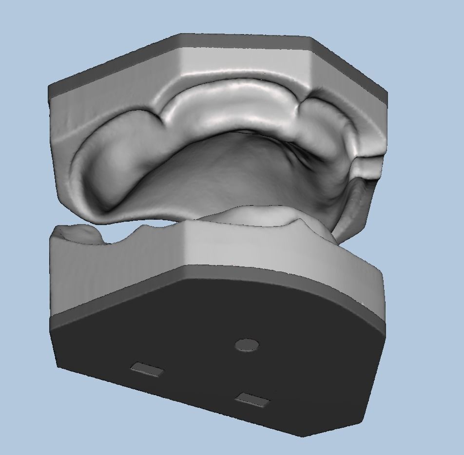 Dental edentulous model separate gum and bone 3D print model_2