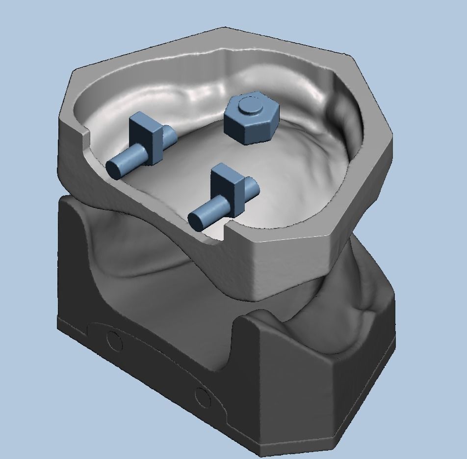 Dental edentulous model separate gum and bone 3D print model_6
