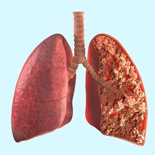 lungs 3D model 3D model