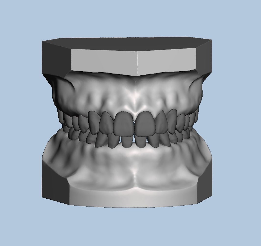 Ortho model style base for typodont 3D print model_5