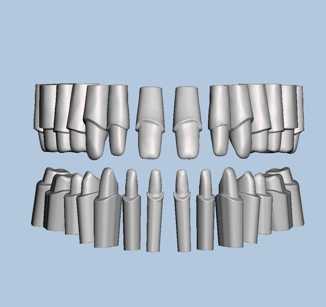 Dental Typodont with full crowns 3D print model_2