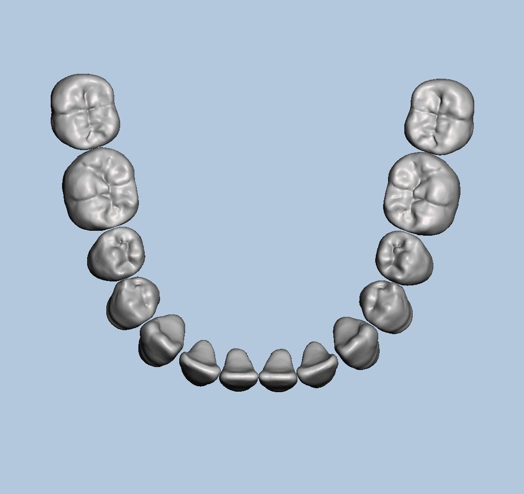 Dental Typodont with full crowns 3D print model_6