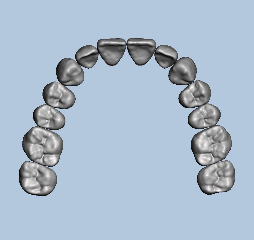 Dental Typodont with full crowns 3D print model_5
