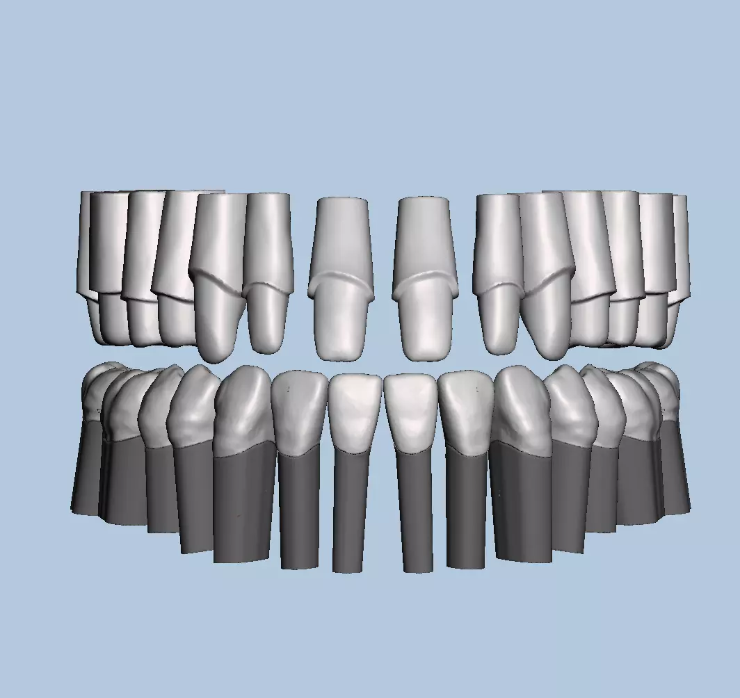 Dental Typodont with full crowns 3D print model_0