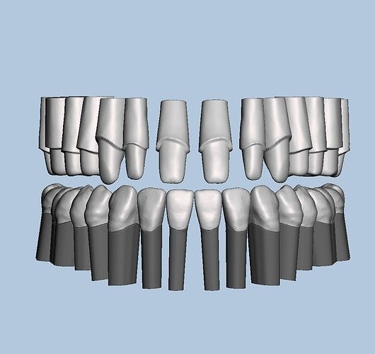 Dental Typodont with full crowns 3D print model