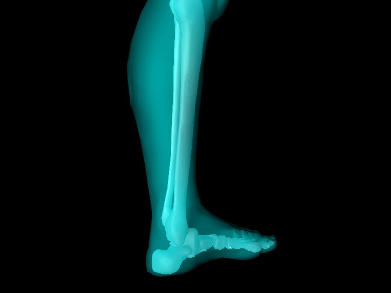 X Ray Ankle Joint Medically Accurate Model 3D model_21