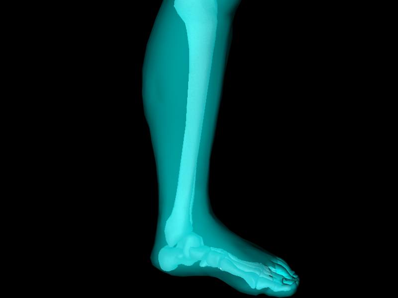 X Ray Ankle Joint Medically Accurate Model 3D model_13
