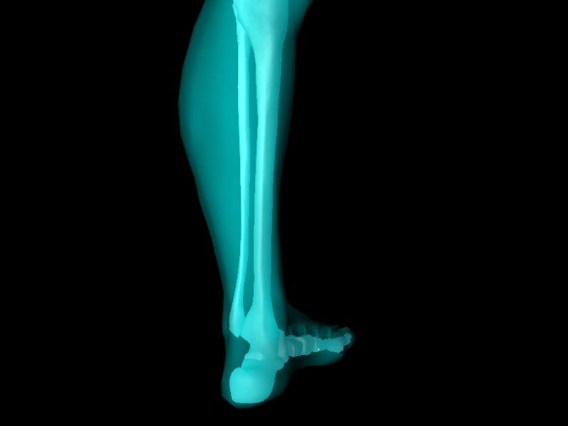 X Ray Ankle Joint Medically Accurate Model 3D model_23