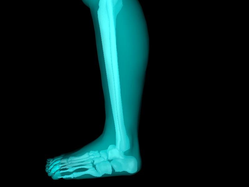 X Ray Ankle Joint Medically Accurate Model 3D model_38